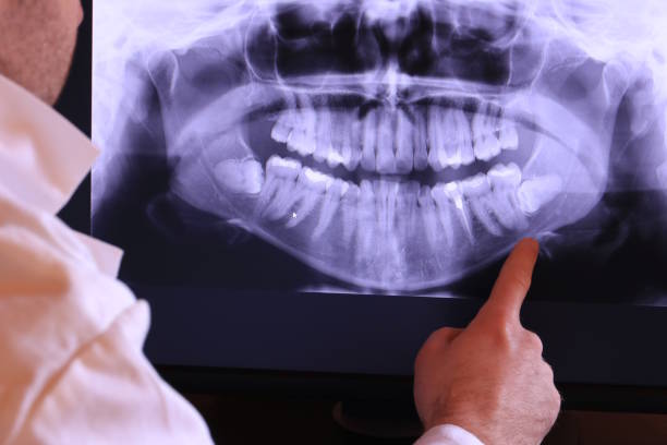 Best Emergency Dental Extractions in Oakton, VA
