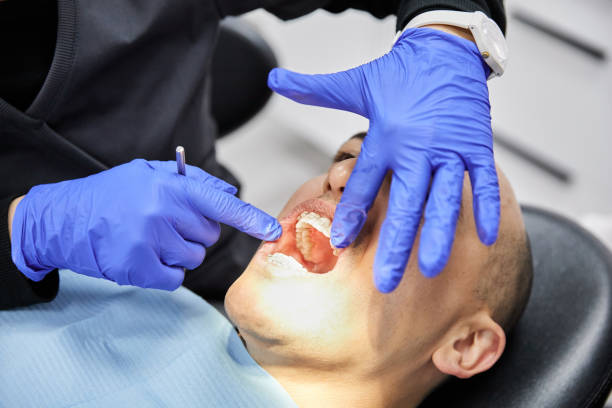 Best Emergency Root Canal Treatment in Oakton, VA