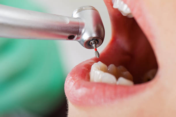 Best Mobile Emergency Dentist in Oakton, VA
